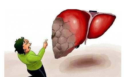 頭部出現(xiàn)這4種狀況，就要注意你的肝了！